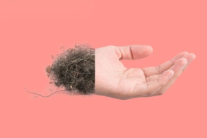 Dead Skin Cells In Dust Facts